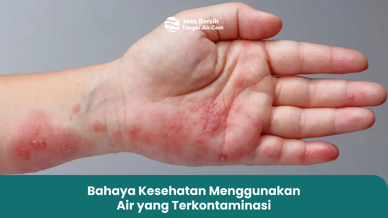 bahaya_kesehatan_menggunakan_air_yang_terkontaminasi_1x